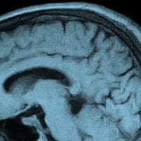 Called SPECT (single-photon emission computerized tomography), the new testing method shows blood flow throughout the brain.